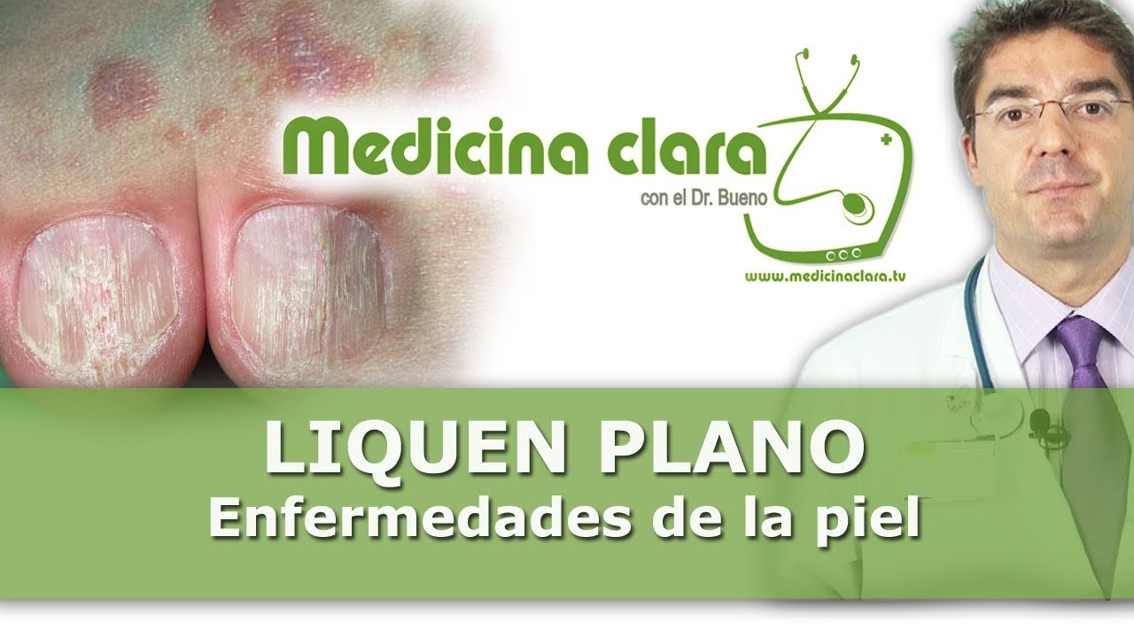 Enfermedades Piel, el liquen plano, síntomas, diagnóstico tratamiento