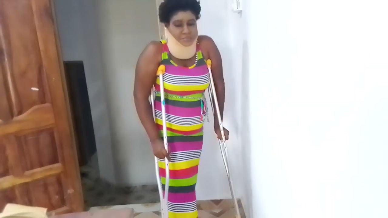 How lady  Tina with different colored attire walks on crutches with long cast
