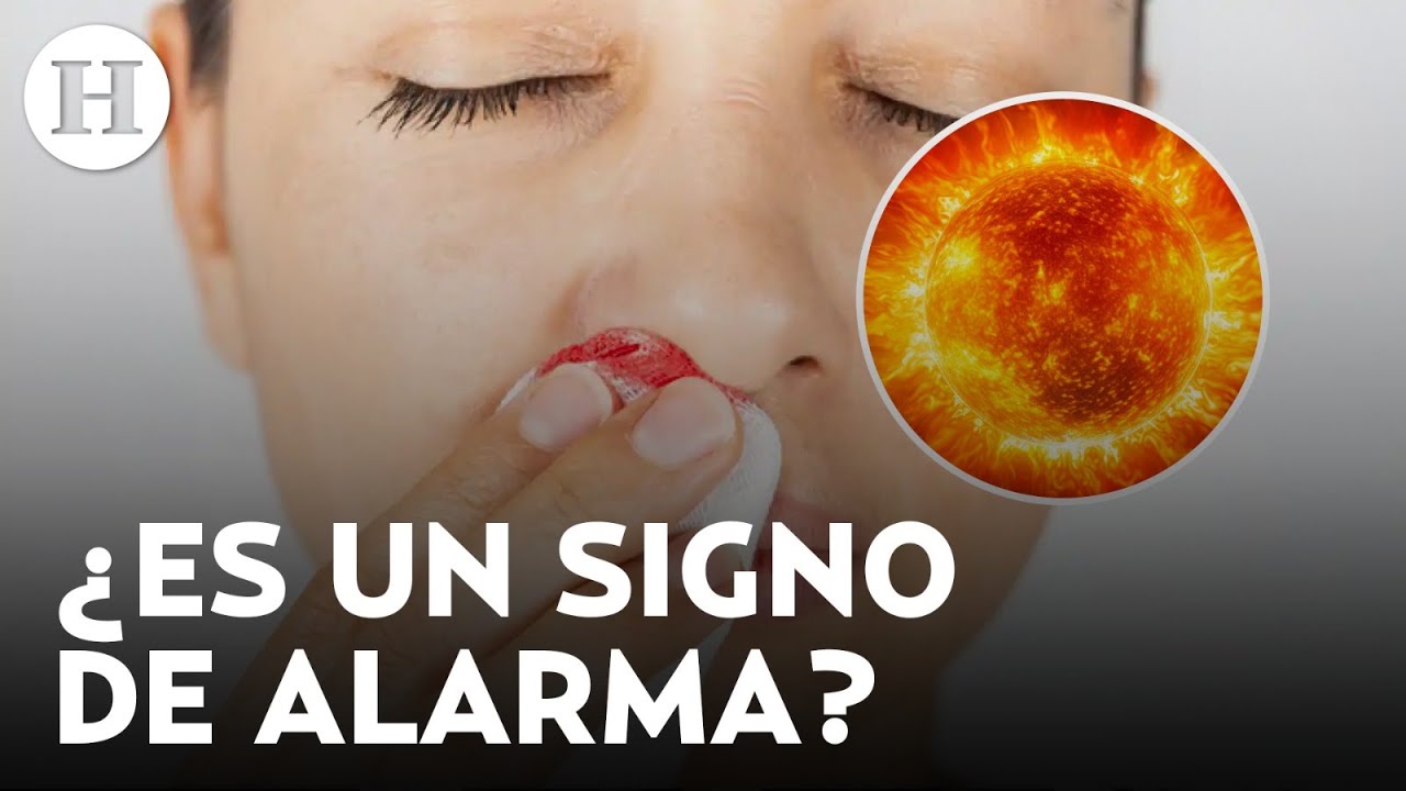 ¿Es peligroso? Esta es la razón por la que te sangra la nariz cuando hace mucho calor