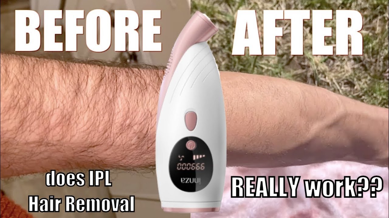 WARNING Do NOT Try IPL Hair Removal Without Watching This