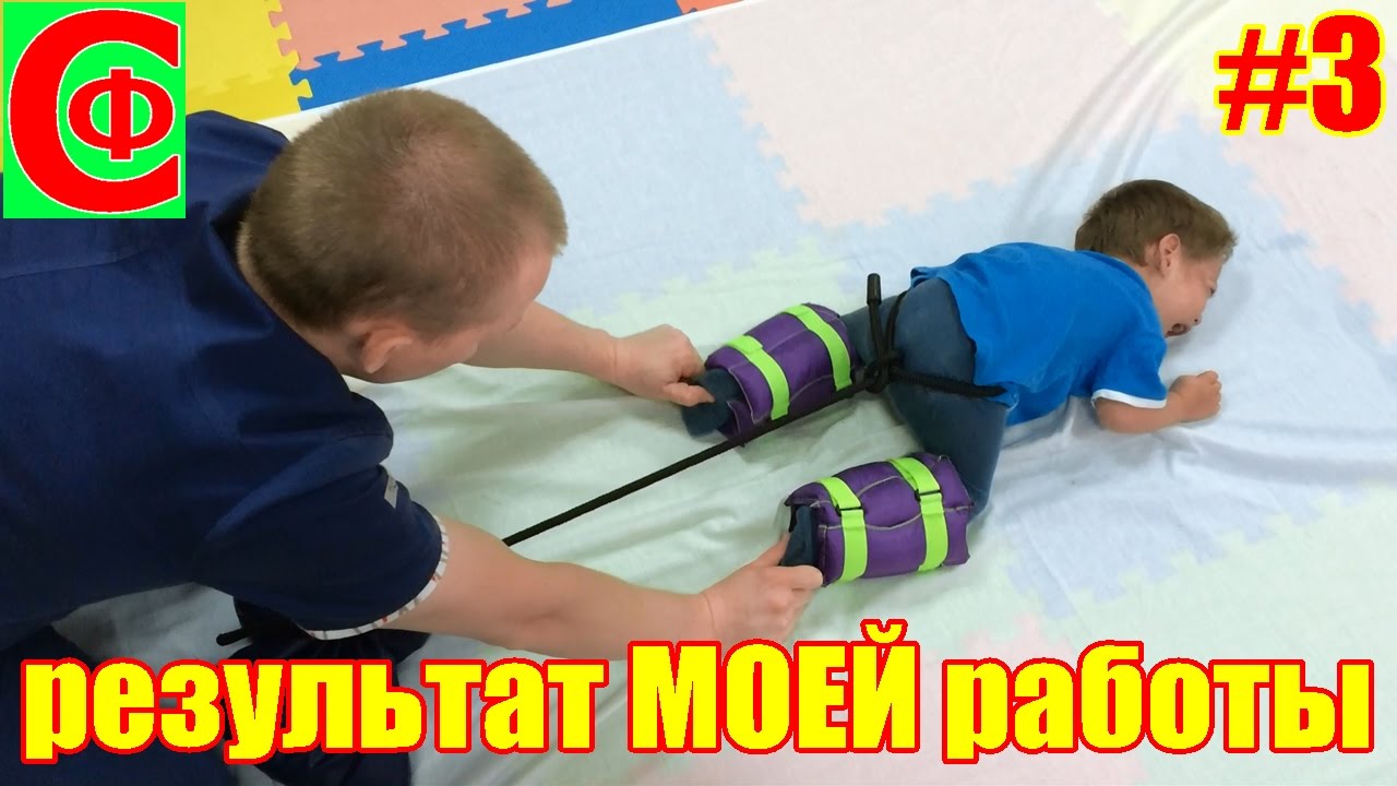 Лечение ДЦП. Результат МОЕЙ работы. Фролков С.В.