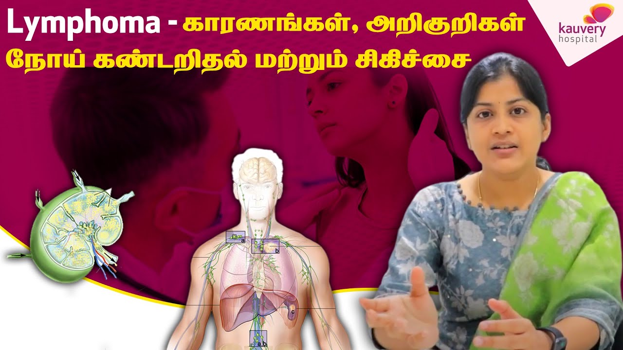 Lymphoma : Causes , Symptoms, Diagnosis and Treatment