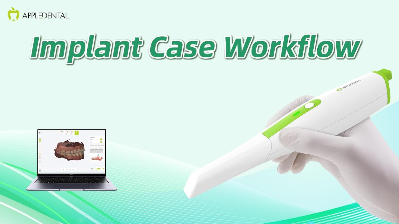 2 Implant Case Workflow  | ECO-SCANNER02