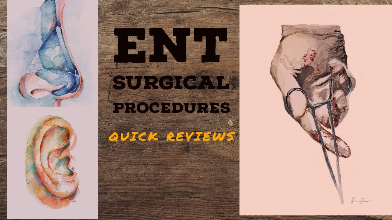 ENT SURGICAL PROCEDURES lecture 2 MYRINGOPLASTY, Tympanoplasty Underlay Overlay techniques made easy