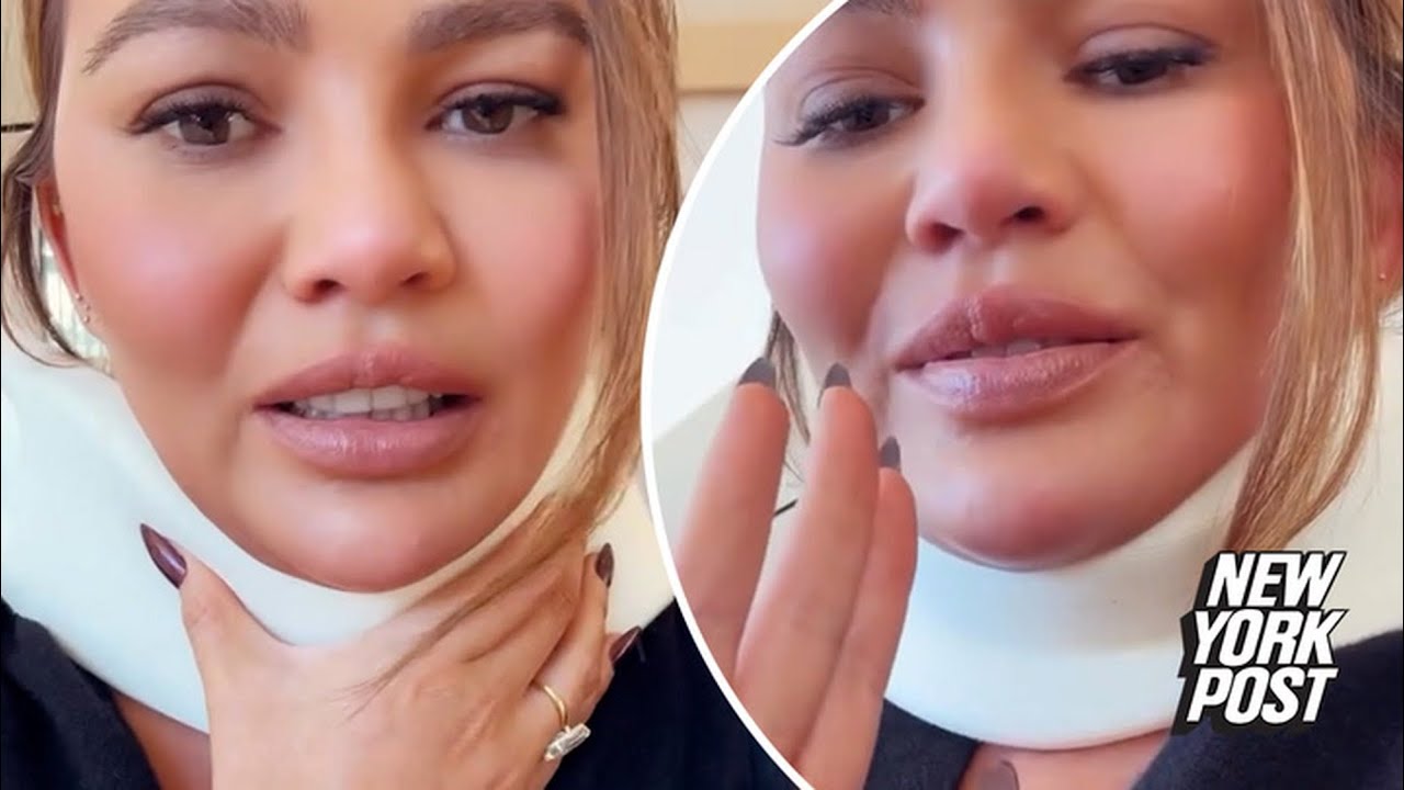 Chrissy Teigen wears neck brace ahead of Met Gala 2024 — here’s what happened