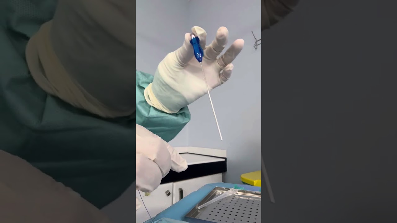 PEG tube insertion تركيب أنبوبة تغذية المعدة وكيفية تثبيت جدار المعدة مع جدار البطن