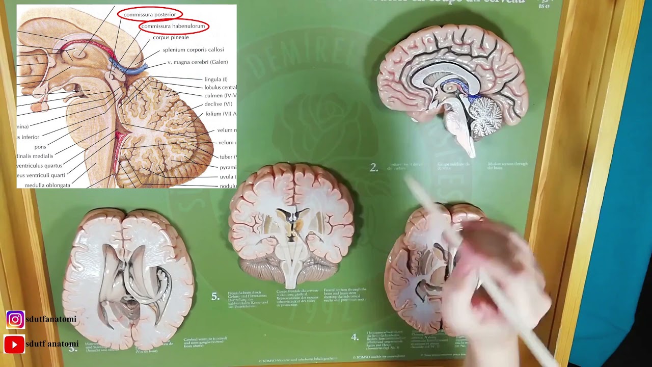 Diencephalon (Bölümleri, Çekirdekleri, Fonksiyonu)