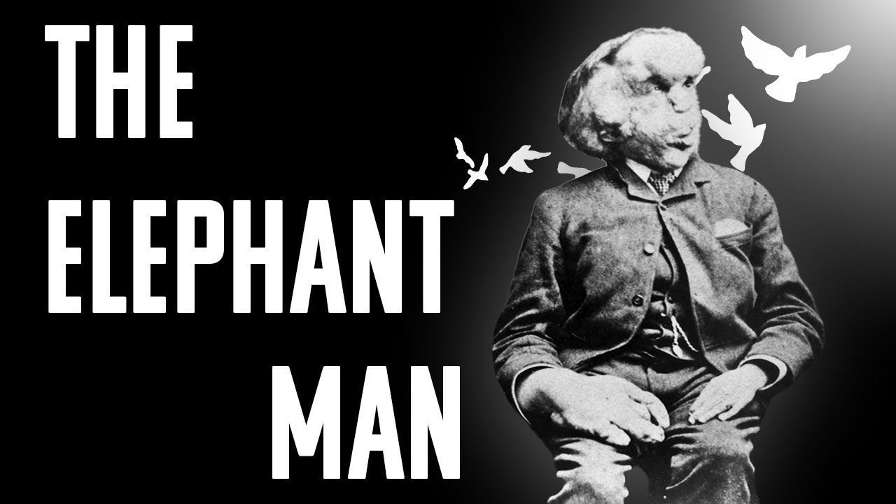 Joseph Merrick | Over the Cuckoo's Nest #3