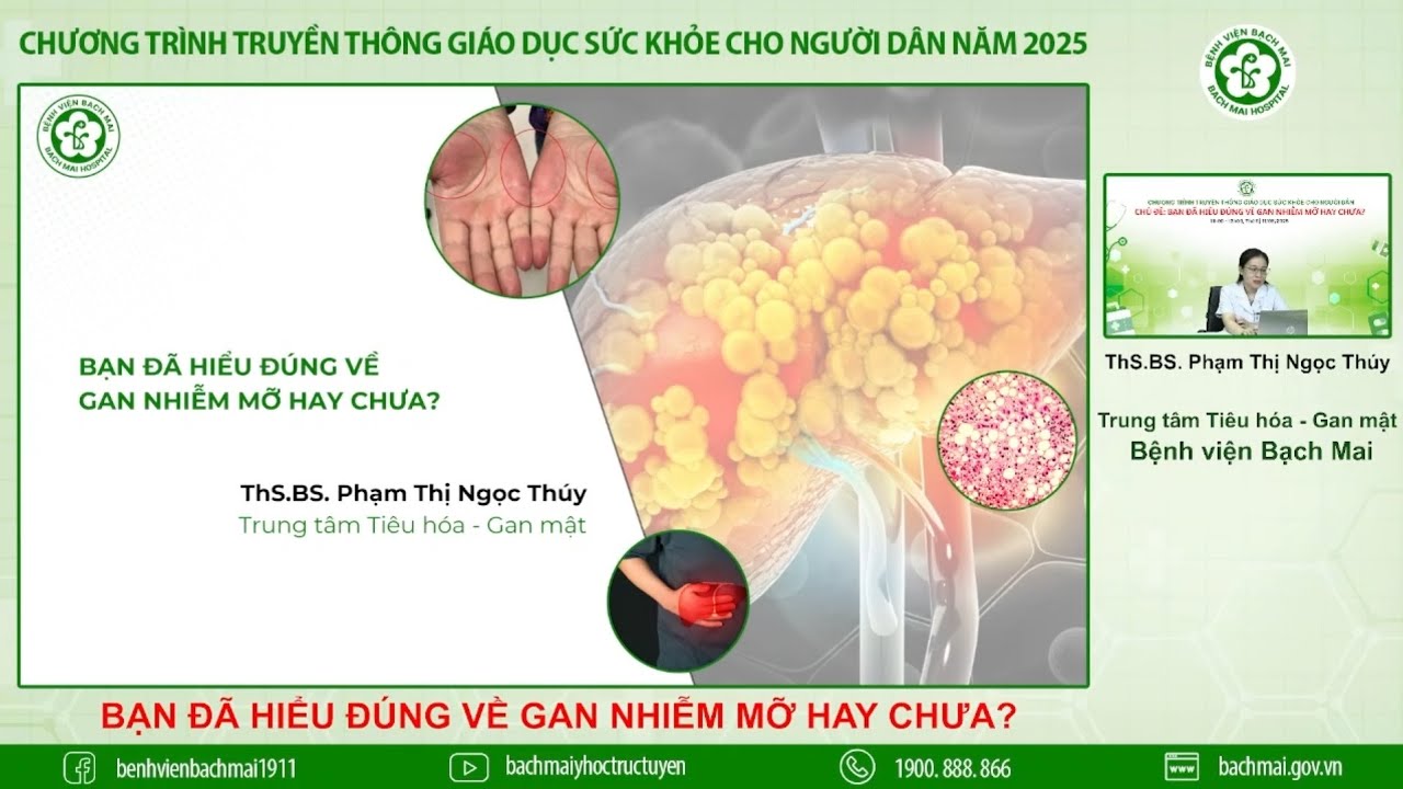 24. Bạn đã hiểu đúng về gan nhiễm mỡ hay chưa?