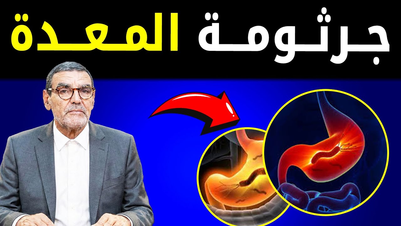 علاج جرثومة المعدة؟ اكتشف السر الذي يقضي عليها نهائيا بوصفة منزلية مع دكتور الفايد 🔥
