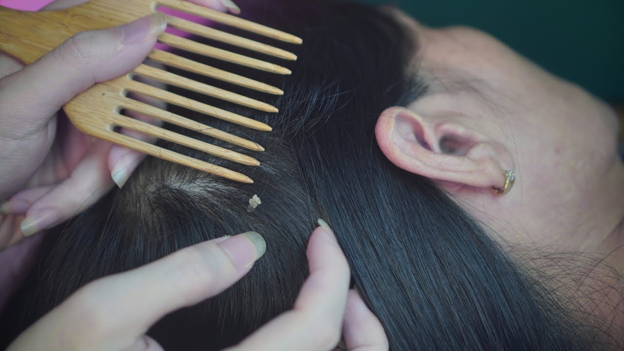 Scalp Cleaning ASMR 🧠 Tingly Scalp Scratching with Hair Parting For Relaxation ( Quiet )