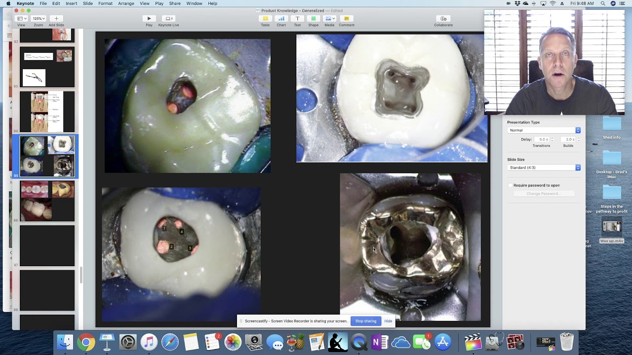 Endo Access Through Crown. Education for dental staff.