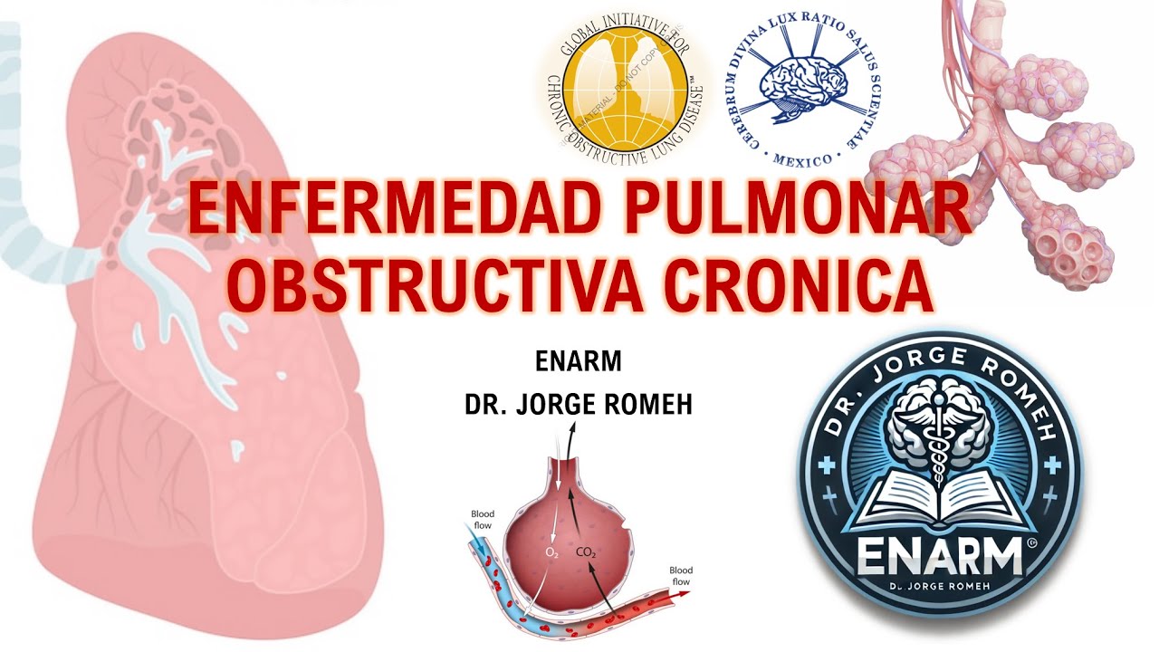 ENFERMEDAD PULMONAR OBSTRUCTIVA CRONICA (EPOC) - ENARM - TODO LO QUE DEBES SABER