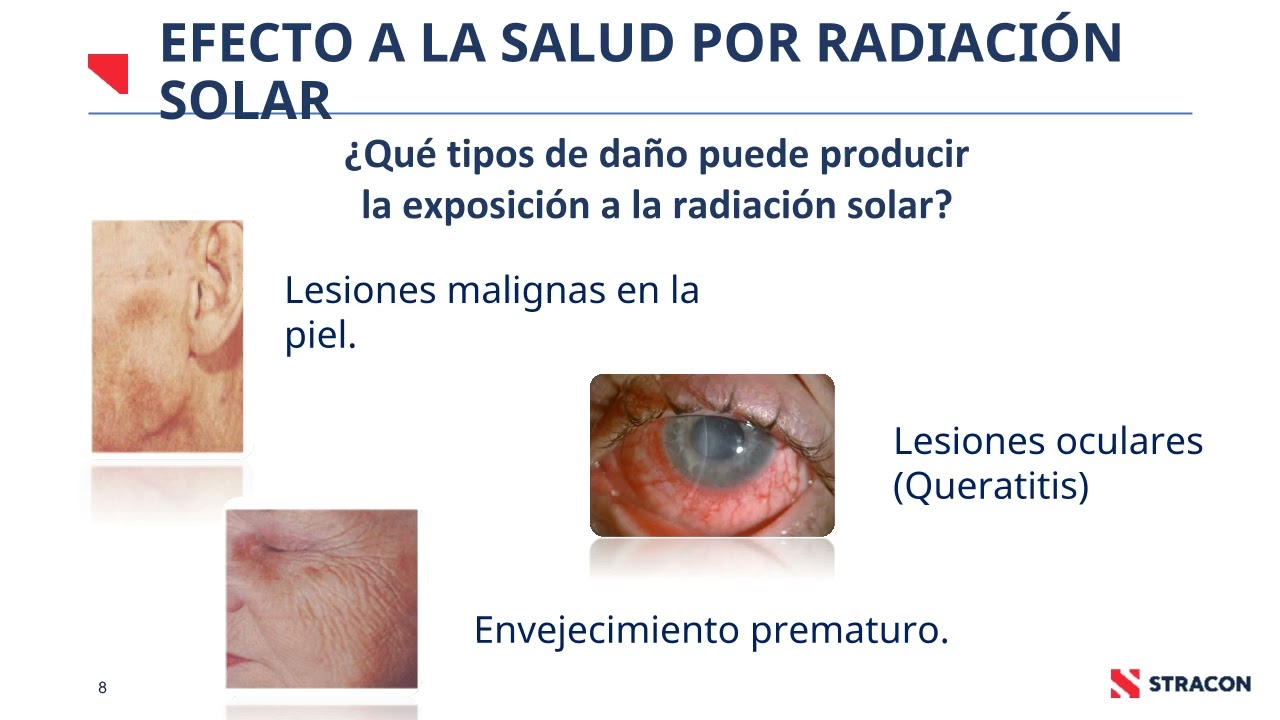 PROTECCIÓN DE RADIACIÓN SOLAR-NOV 2025