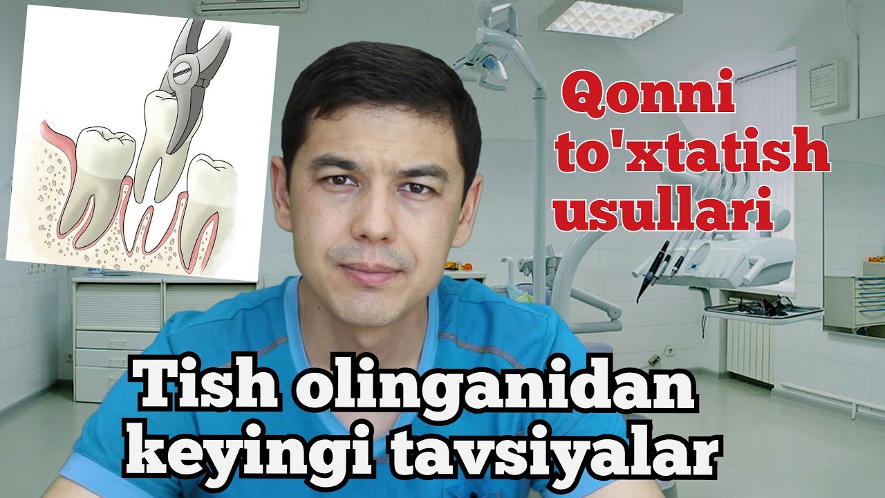 TISH OLINGANIDAN KEYINGI TAVSIYALAR / Тиш олинганидан кейинги тавсиялар
