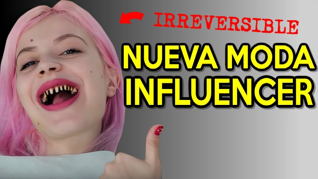 Están HACIENDO ESTO para ser mas BELLOS  👀🦷🧛‍♂️- Limarse los dientes en Turquía | Anita