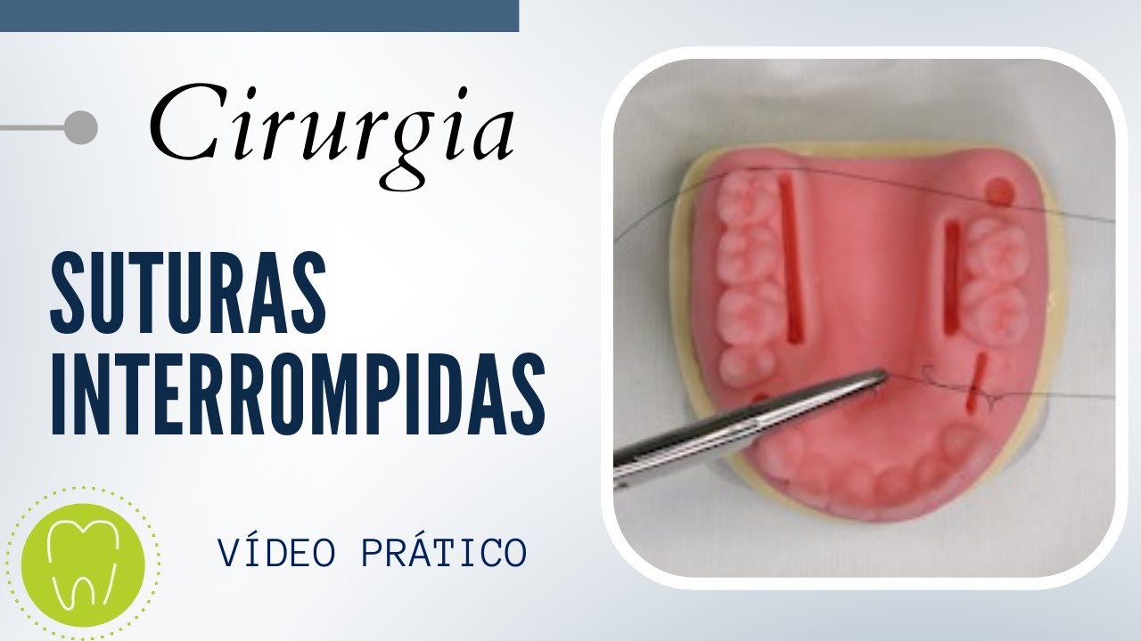 SUTURAS INTERROMPIDAS | Sutura em X | Ponto simples | Colchoeiro horizontal | Colchoeiro vertical