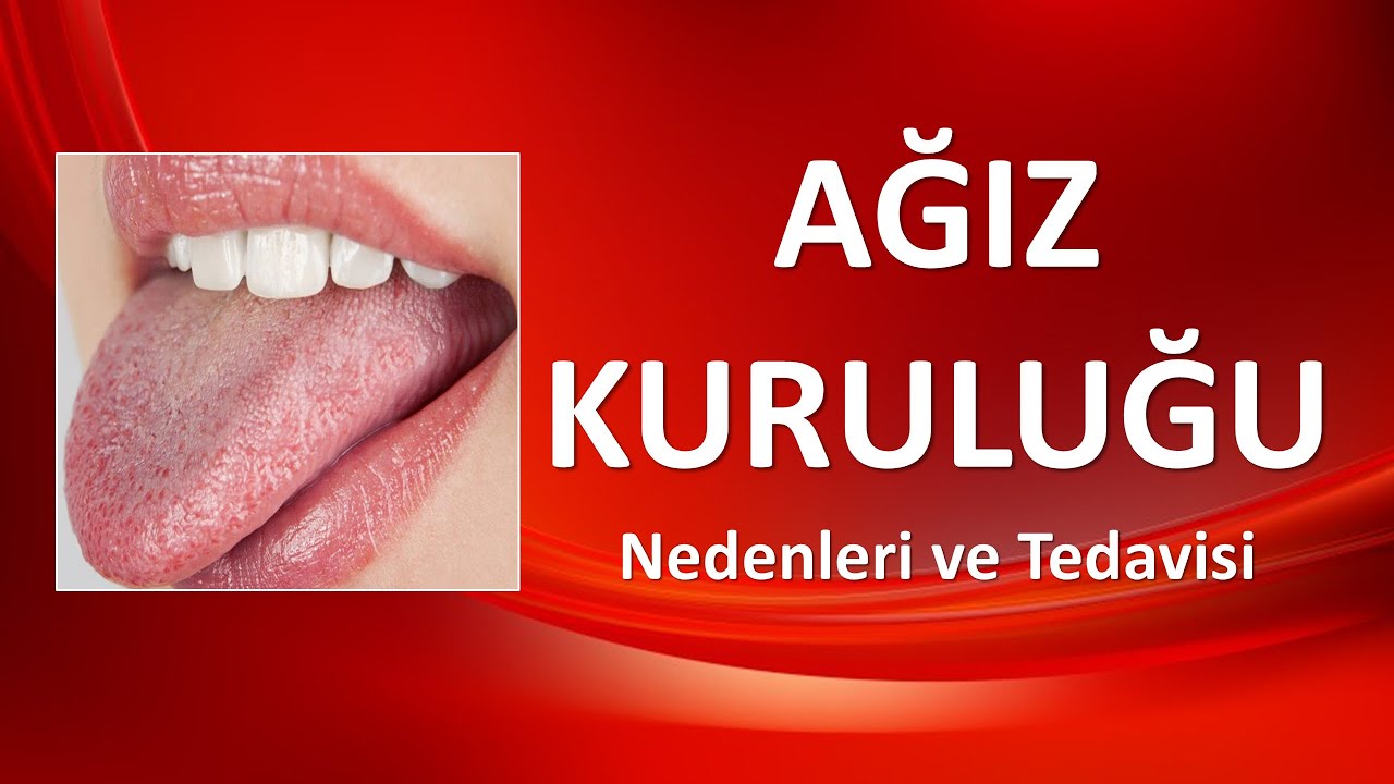 AĞIZ KURULUĞU Nedenleri ve Tedavisi