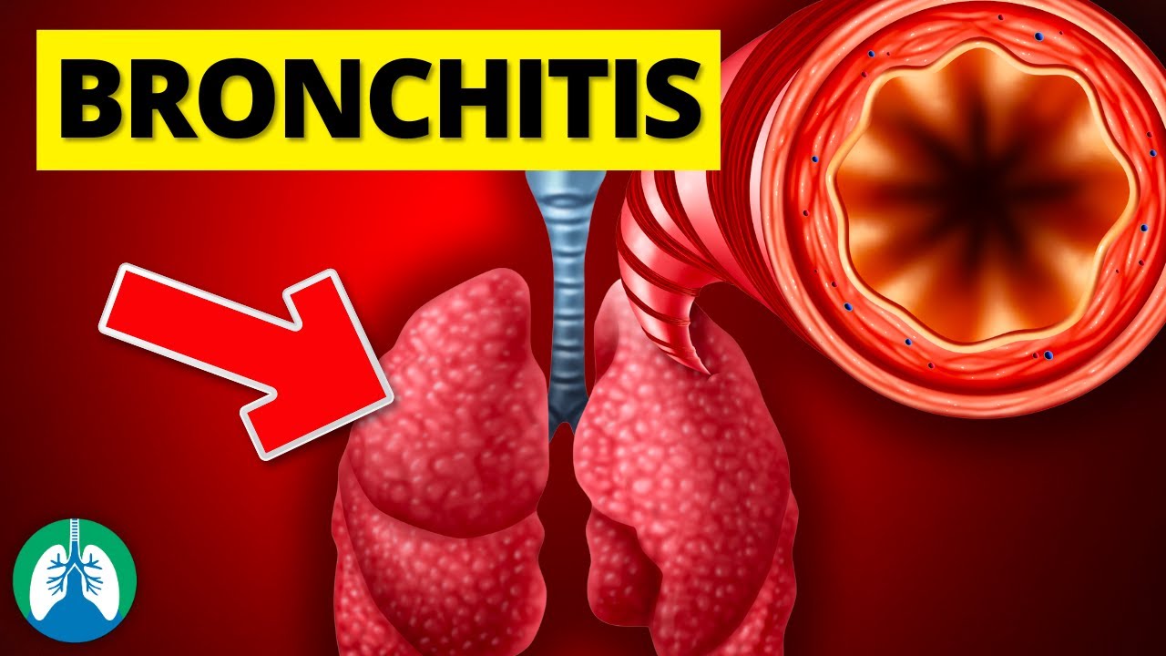 Bronchitis (Medical Definition) | Quick Explainer Video