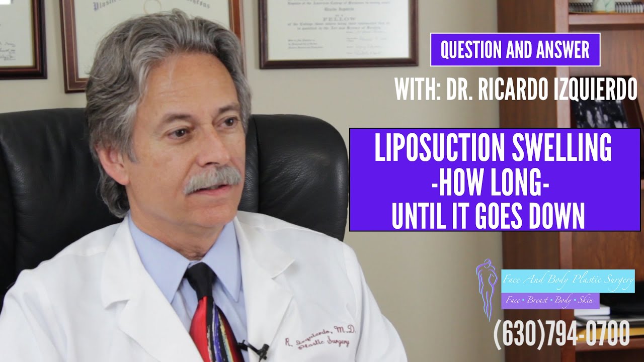 Liposuction Swelling &ndash; How long until it goes down
