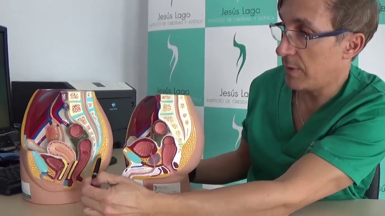 Dr. Jesús Lago - Vaginoplastia Simple