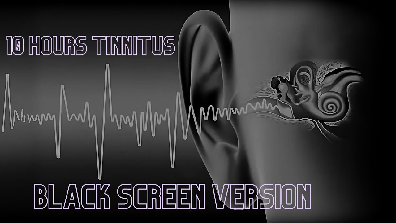 NEW Black Screen version - 10 HOURS Tinnitus Masking Sounds