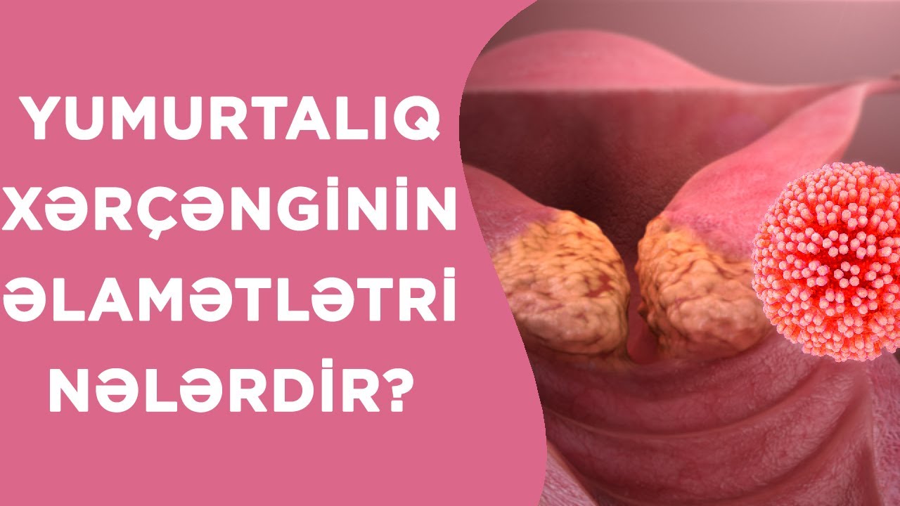 YUMURTALIQ XƏRÇƏNGİNİN ƏLAMƏTLƏTRİ NƏLƏRDİR❓