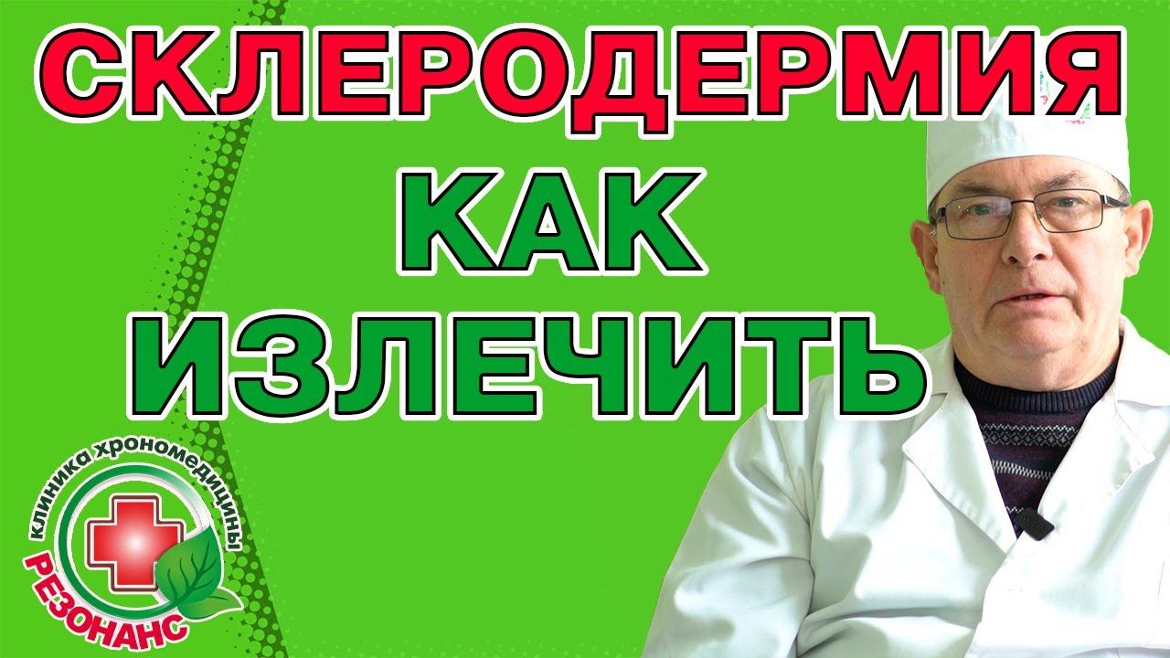 Склеродермия, что это? Как вылечить заболевание склеродермия? Системная склеродермия лечение