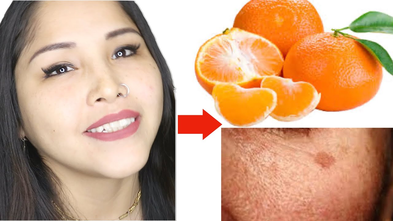 Remueve MANCHAS EN 1 DIA con UNA MANDARINA - Maya Belleza de la India