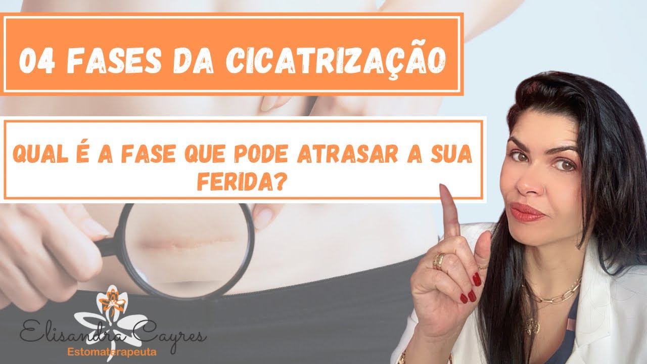 04 FASES DA CICATRIZAÇÃO - ESTOMATERAPIA