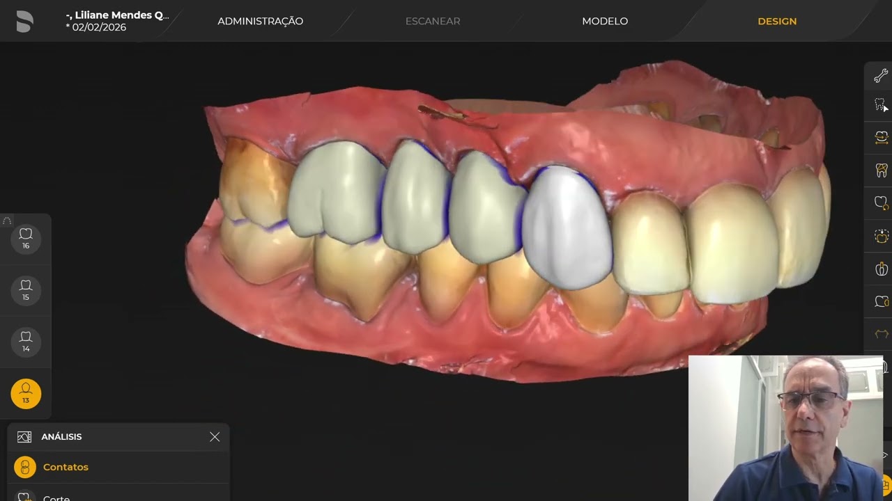 Uso do Inlab para casos complexos - vídeo 1