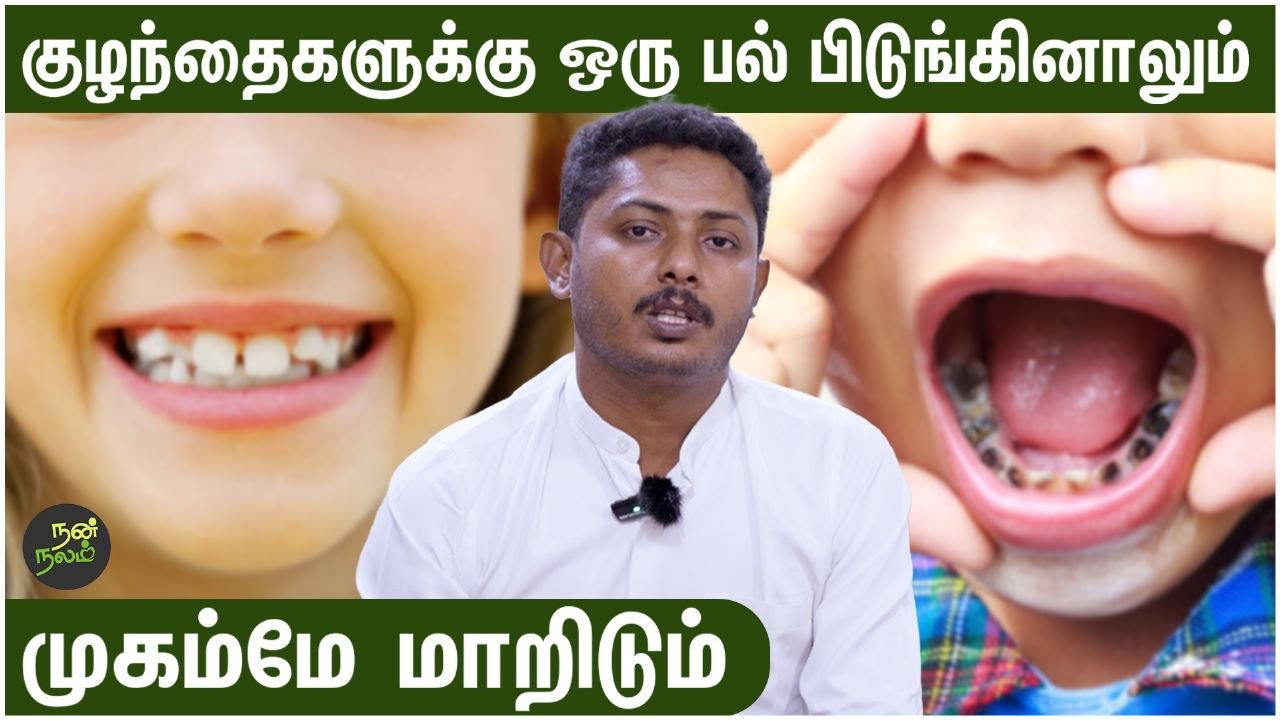 குழந்தைகளின் பல் சொத்தை தடுப்பது எப்படி? - Dr Aravind Dentist | Tooth Decay in Children