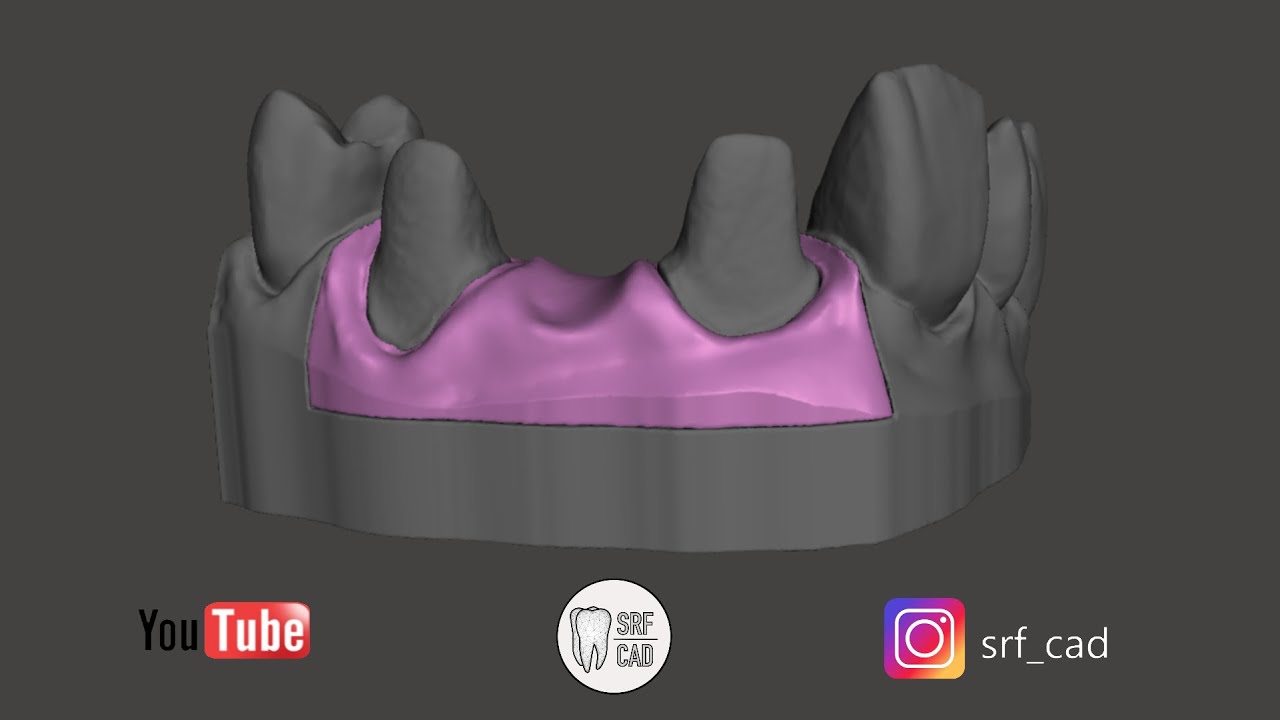 MESHMIXER DENTAL: Tutorial come creare una gengiva separata da scansione  intraorale removable encía