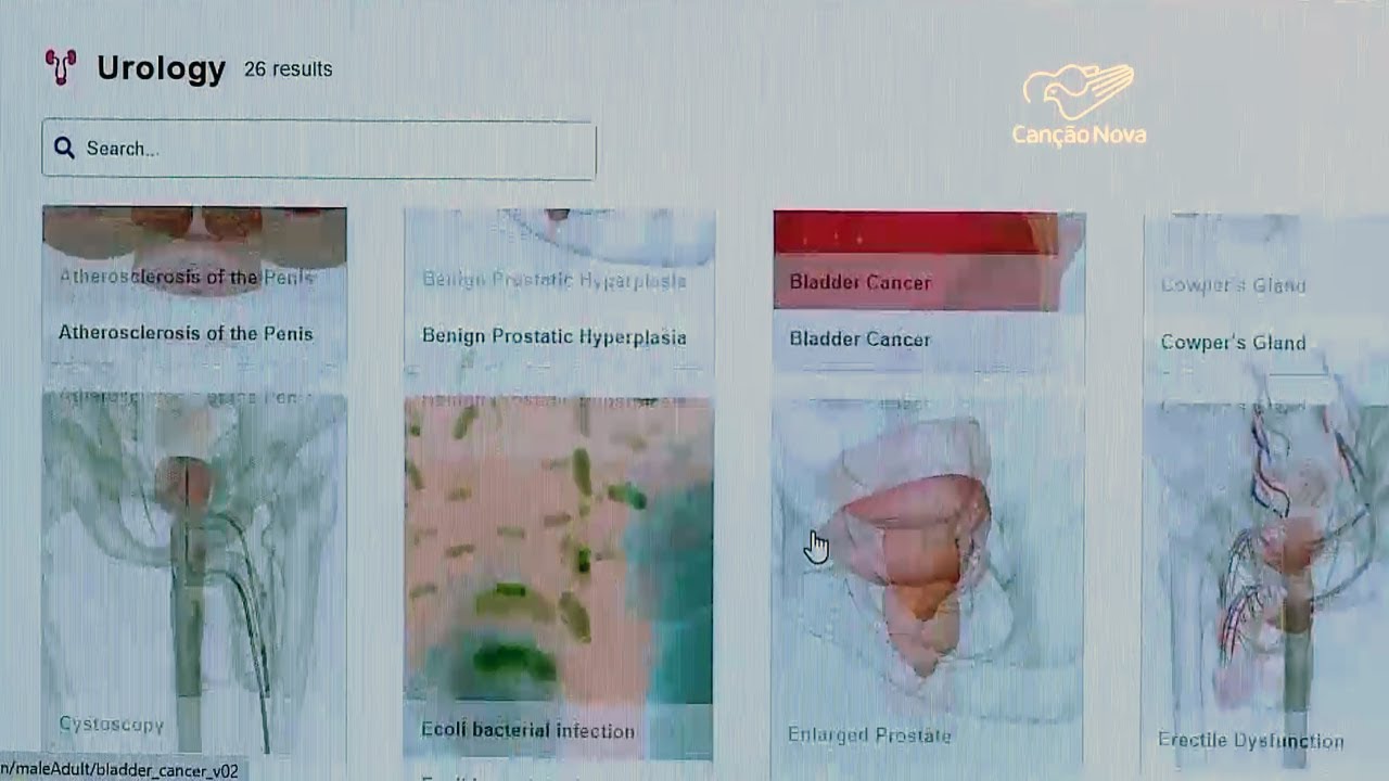 Especialistas alertam sobre cuidados para se evitar o AVC