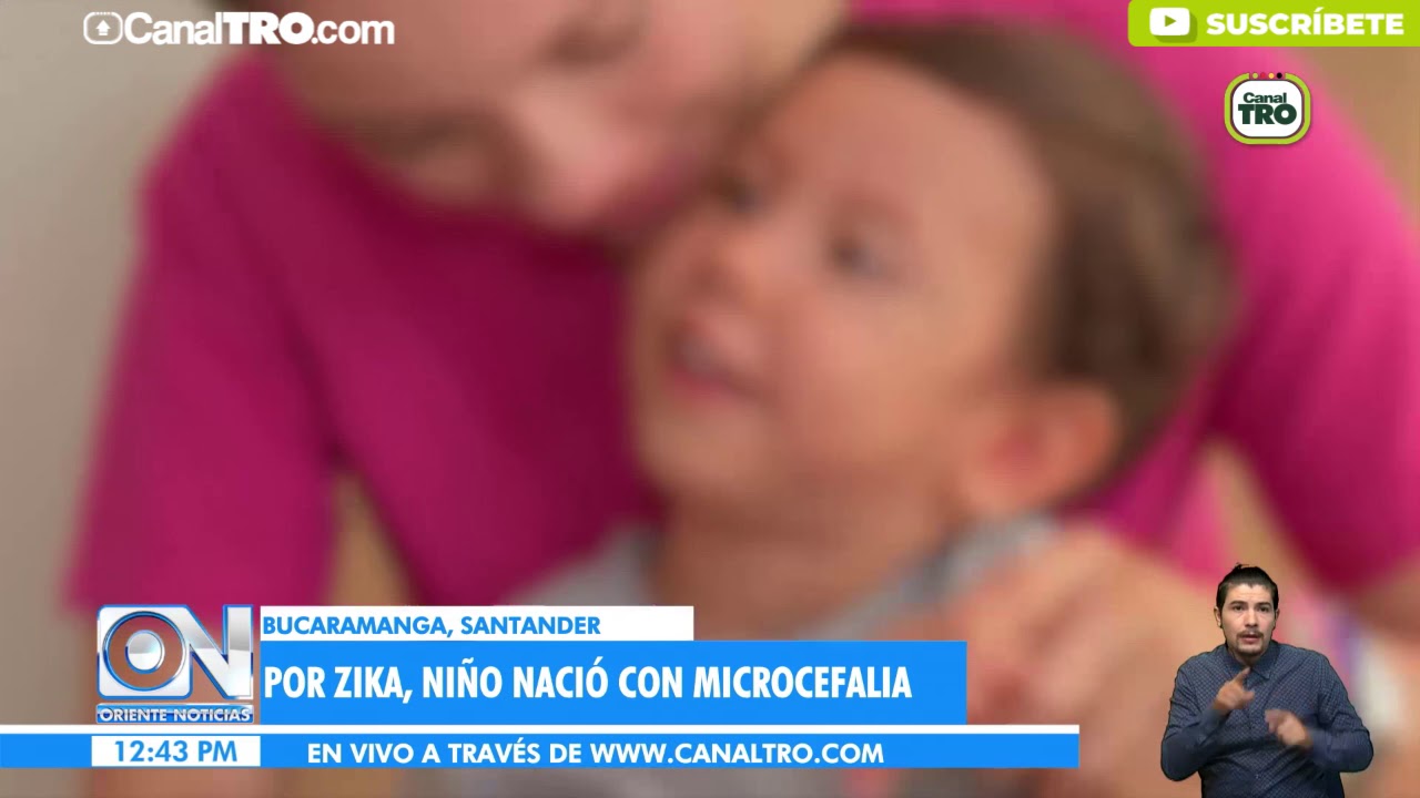 Esperanza de vida para un niño con microcefalia en Bucaramanga