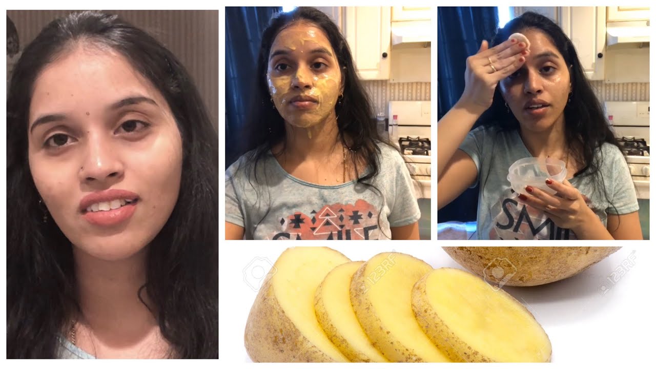 I tried potato facial for the first time/amazing results/best facial for dark spots and pigmentation