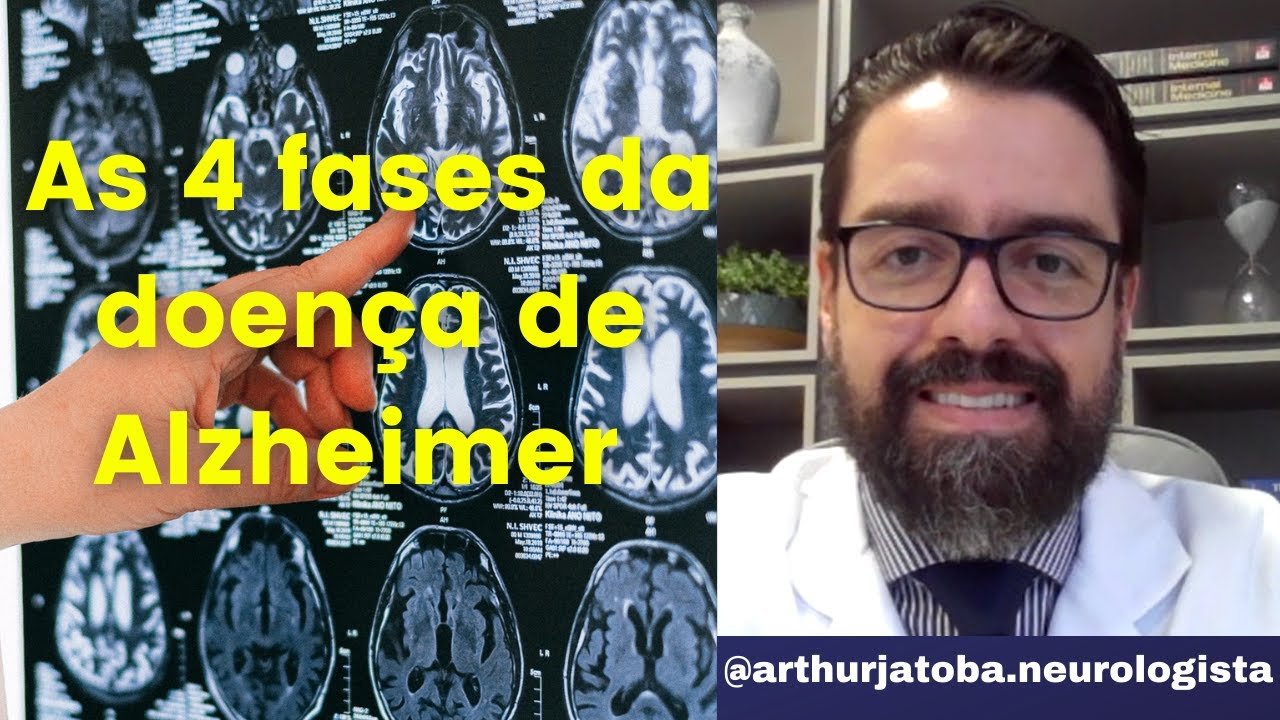 QUAIS S&Atilde;O AS FASES DA DOEN&Ccedil;A DE ALZHEIMER?