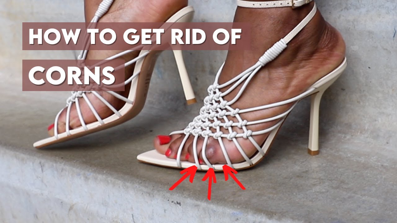 How to Safely Remove a Foot Corn at Home