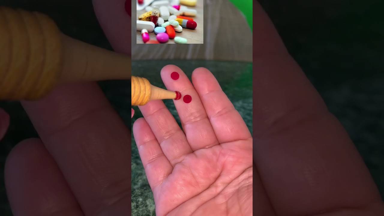acupressure points for reduce side effects of antibiotics naturally ( part 1) 