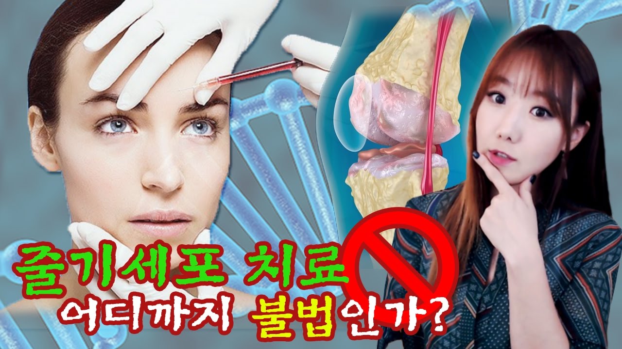 [금사파]#1 줄기세포치료 어디까지 불법인가?ㅣ금요사건파일ㅣ디바제시카