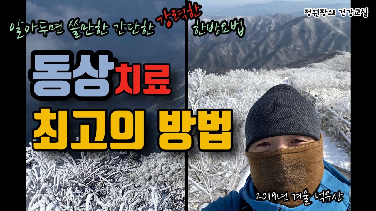 동상 치료 최고의 방법/알아두면 쓸만한 간단한 한방요법/정원장의 건강교실.34