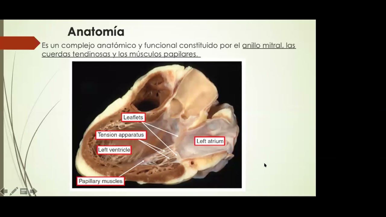 Patología mitral