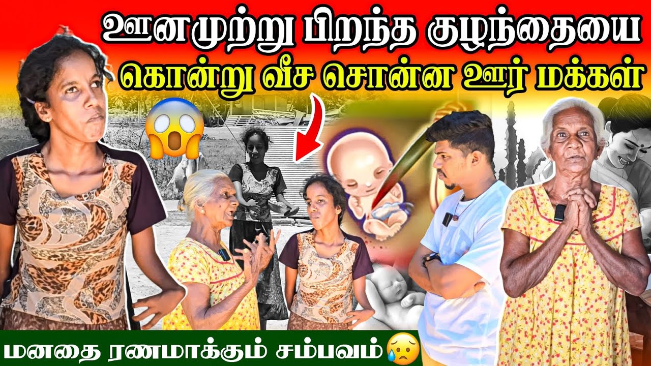 ஊனத்தை காரணம் காட்டி உதறிச் சென்ற தாய் 😥| தாய்க்குப் பதிலாக வளர்க்கும் பாட்டி | Rj Tamizha