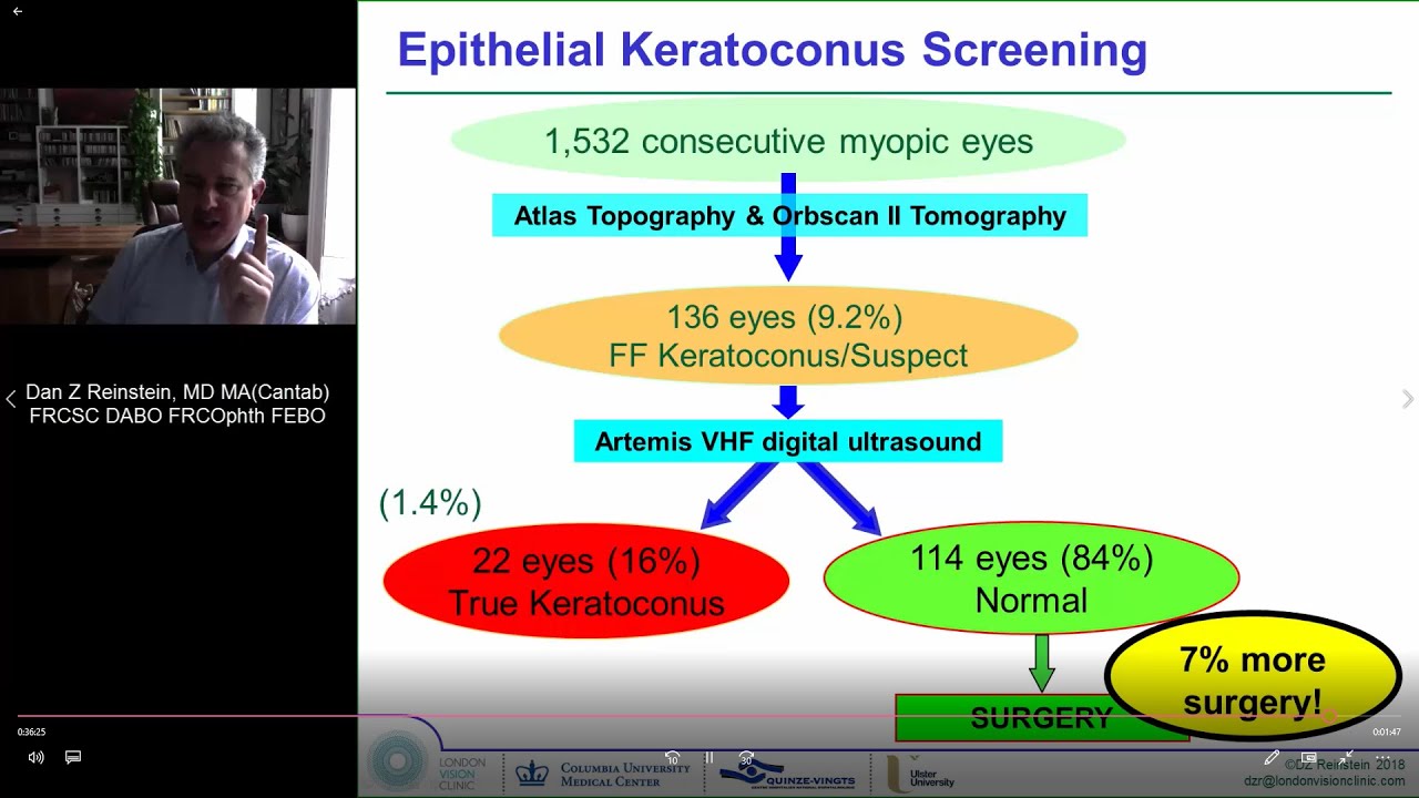 Epithelial Thickness Mapping (ETM) & Refractive Surgery