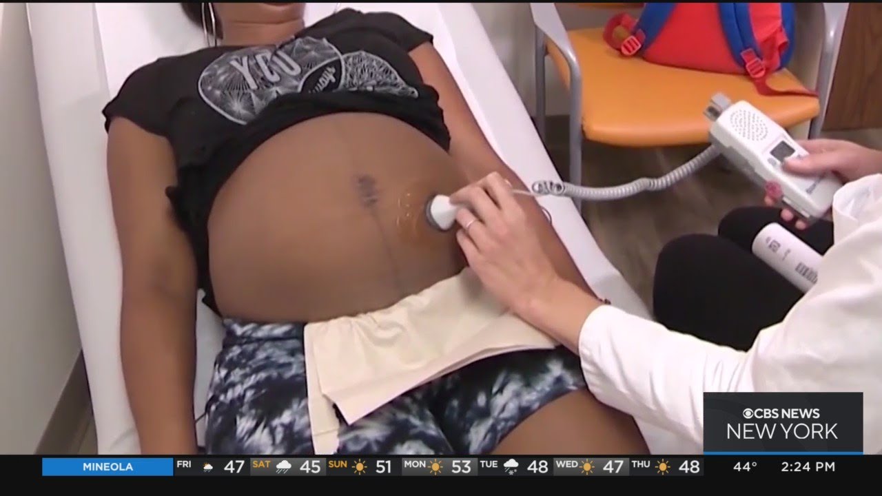 Study: Black women at disadvantage in childbirth