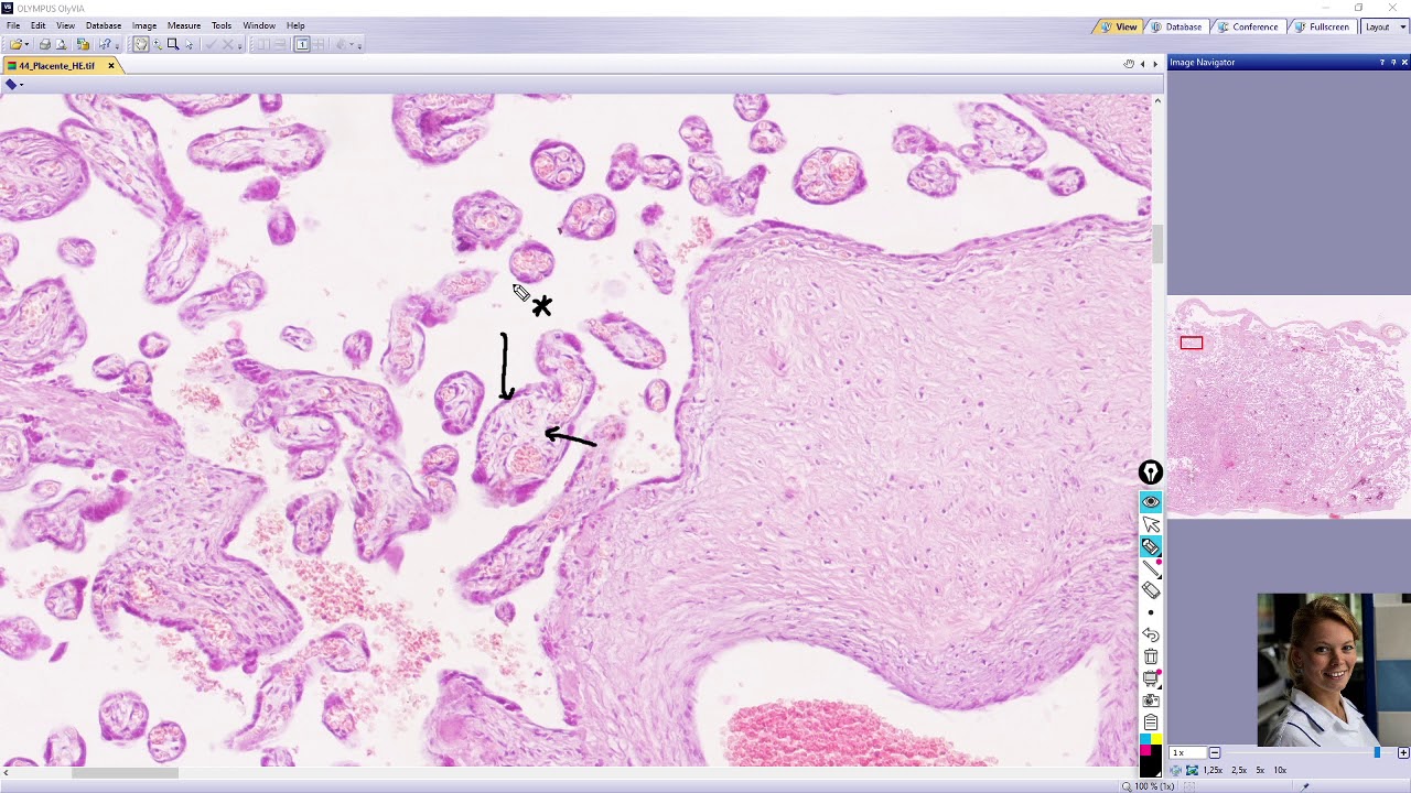 placenta
