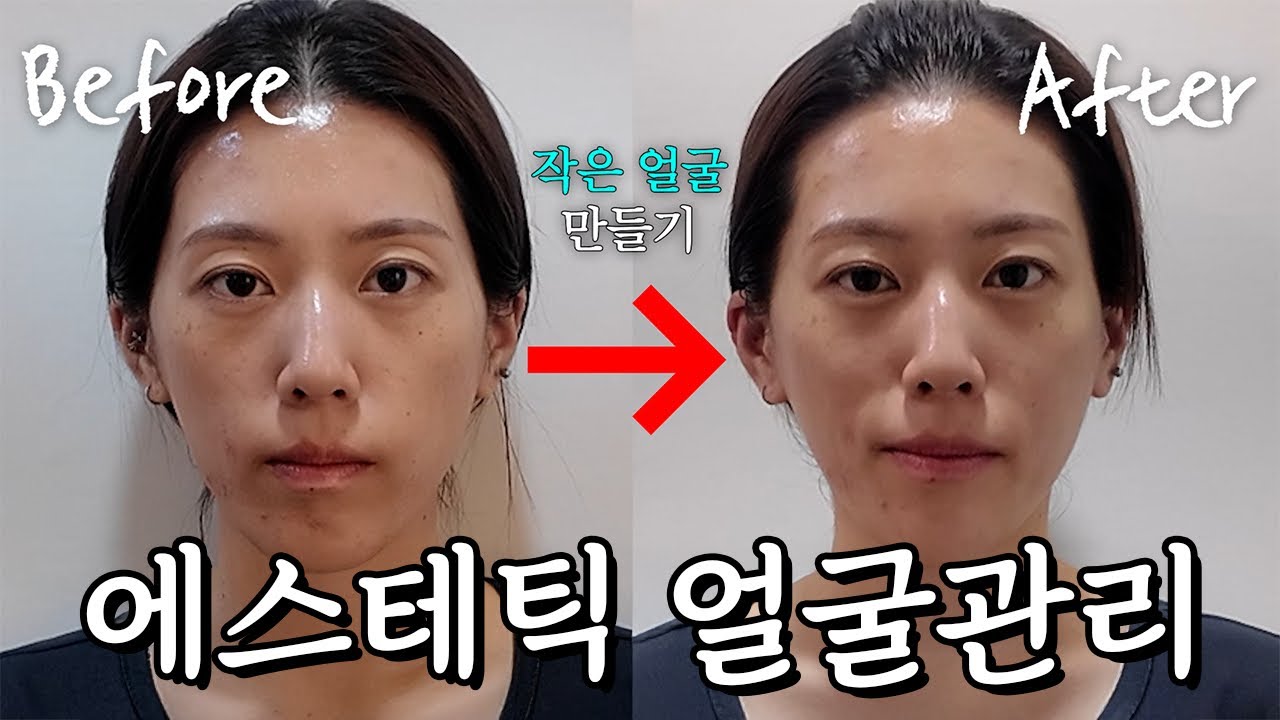 1회 에스테틱 체험하기🤩 얼굴소멸관리 효과가 있을까? | 피부관리, 신부관리, 두피관리, 윤곽관리, 붓기 관리, 주걱턱