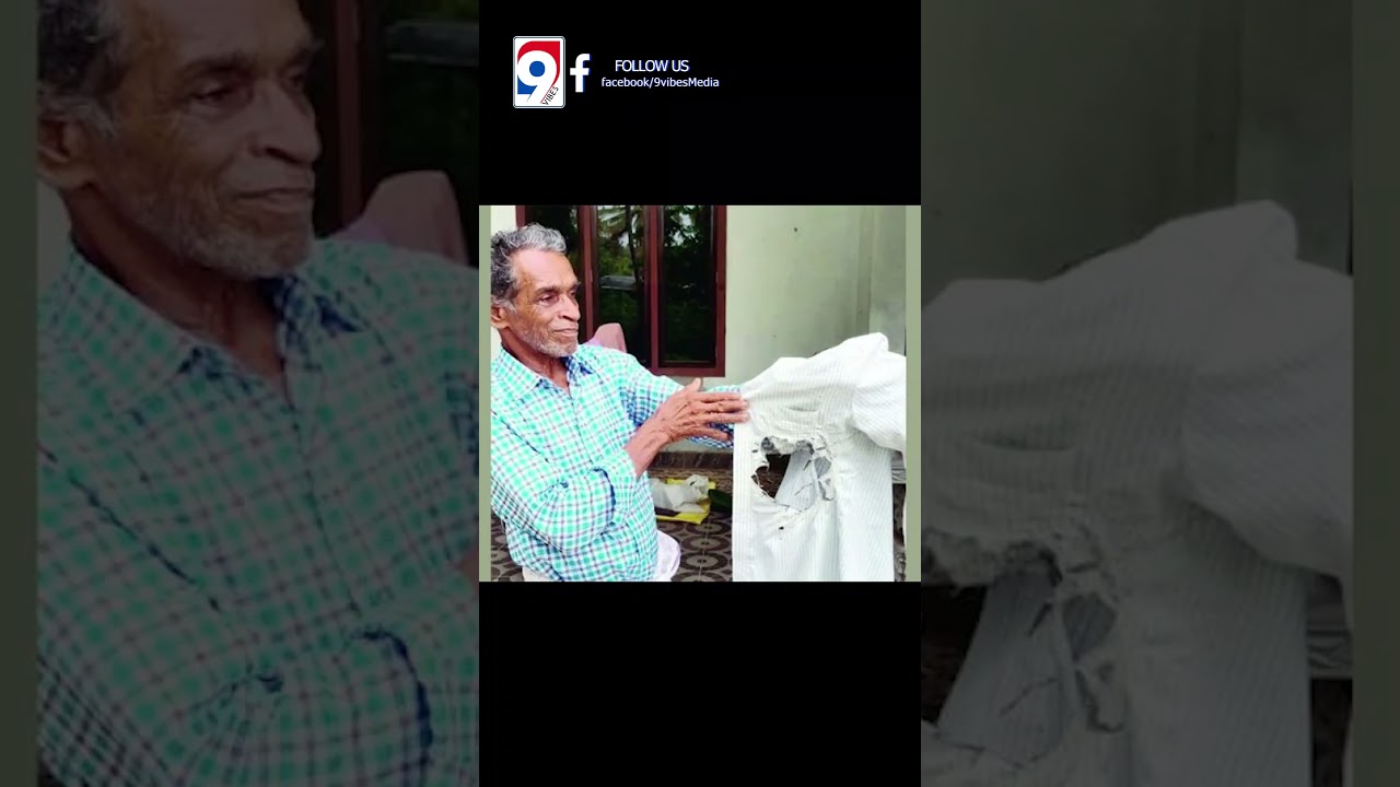 76 year-old man narrowly escape disaster as his mobile explodes in shirt pocket