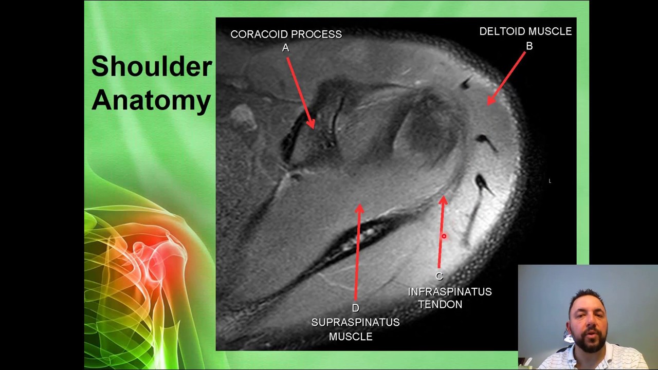Basics of MRI Musculoskeletal