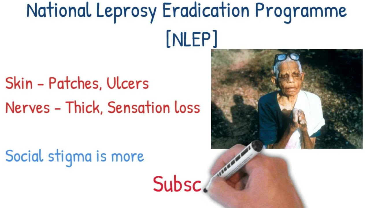 National Leprosy Eradication Programme [NLEP]